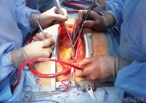 Cardiovascular & Thoracic Surgery